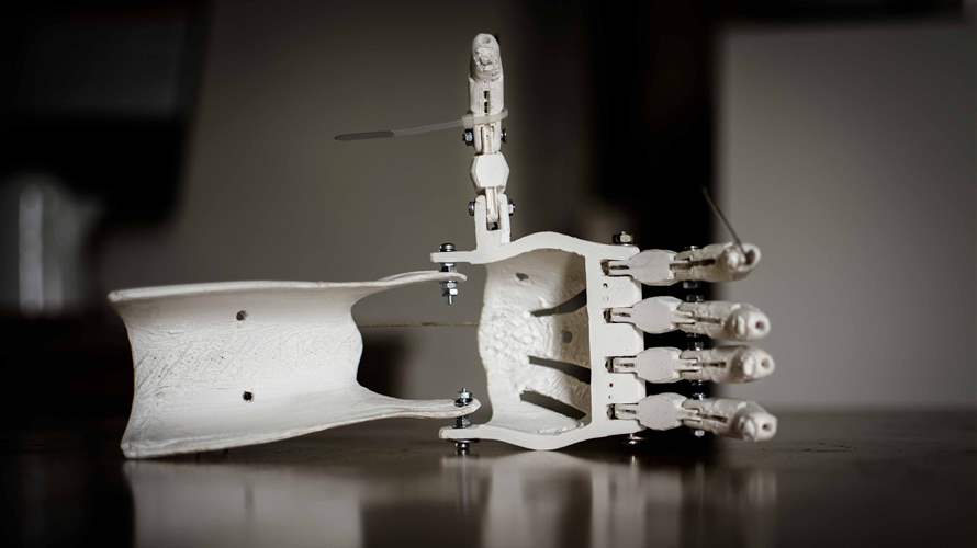Australian engineers create 'flexible robot' for 3D printing inside the body