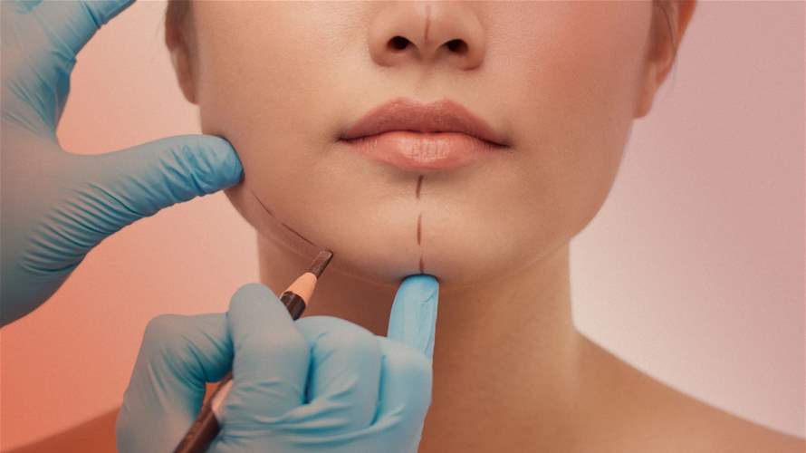 Cosmetic tourism: Lebanon's alluring industry for Arab tourists