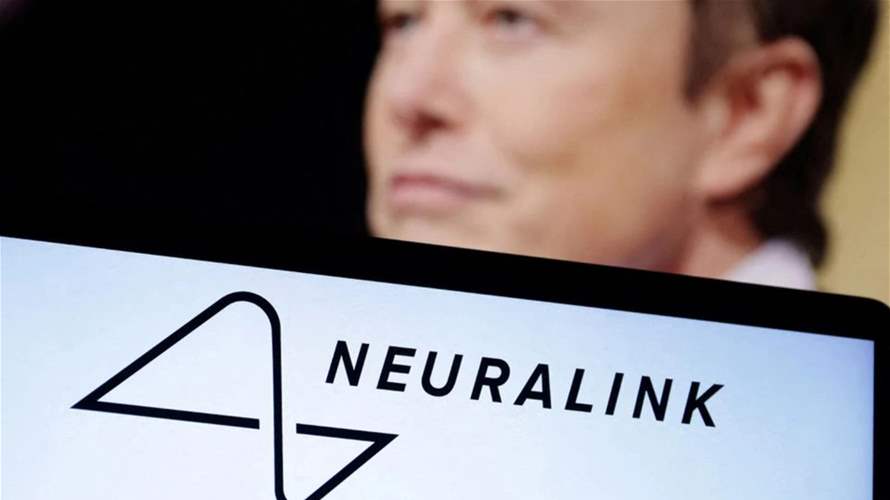 Elon Musk's Neuralink says it has FDA approval for study of brain implants in humans