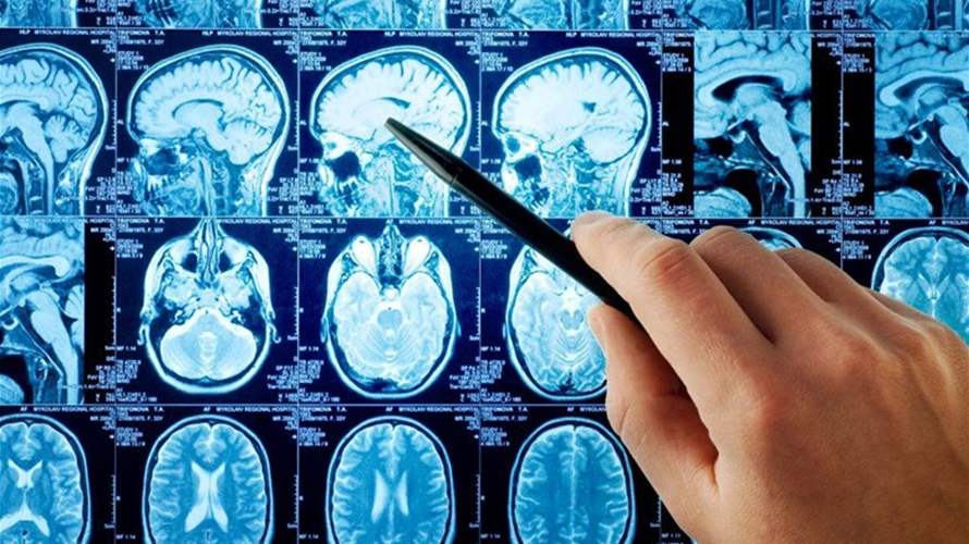 بعد سنوات من الركود... خرق "واعد" في البحوث لعلاج انفصام الشخصية 