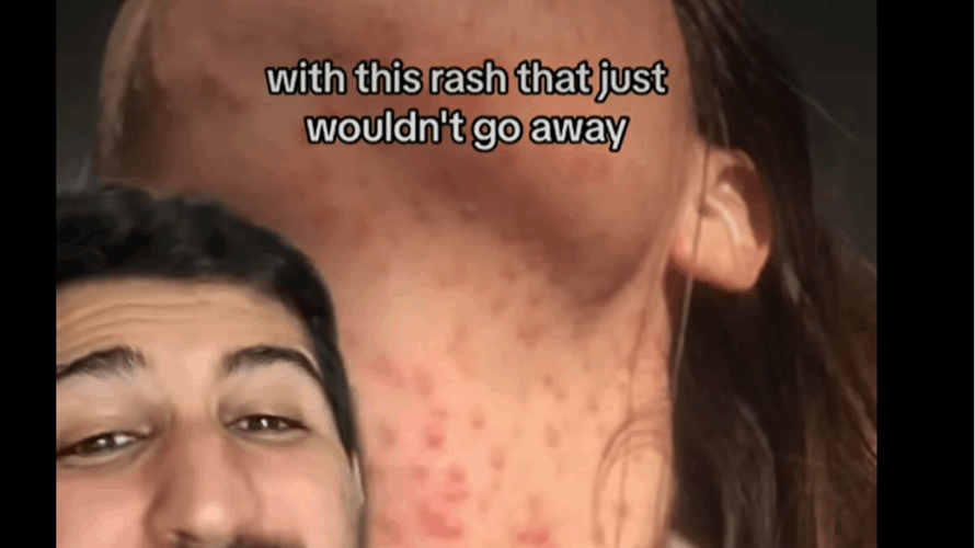 "تحتوي على بكتيريا أكثر من المرحاض"... طبيب يحذر: مادة شائعة بحقائب المكياج النسائية يمكن أن تؤذيهن بشكل مرعب! (فيديو)