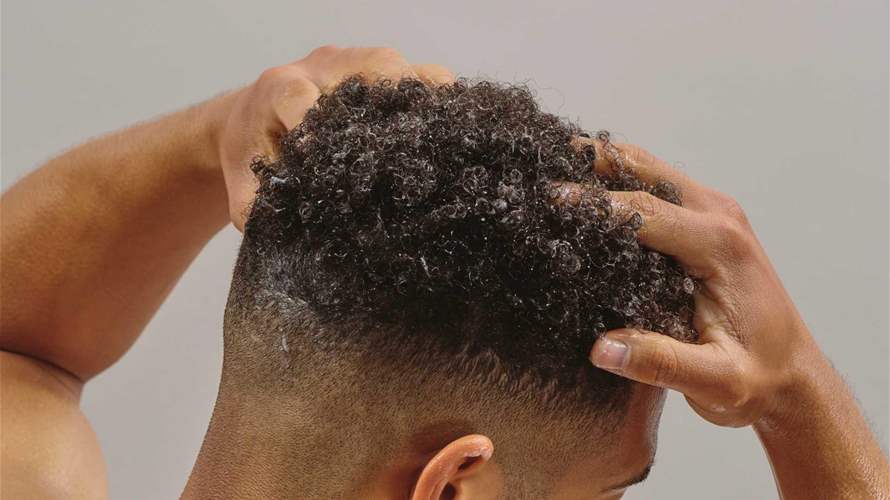 رجل ينفق أكثر من 6000 دولار على عملية زراعة الشعر... تحول مذهل في مظهره! (صورة)