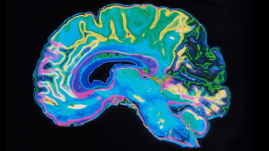 دماغ الرجل لا يشبه دماغ المرأة... دراسة جديدة تكشف أمورًا مهمة!