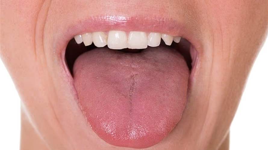 من اللون إلى الشكل والبقع... علامات على لسانك لا يجب تجاهلها وهذا ما تكشفه