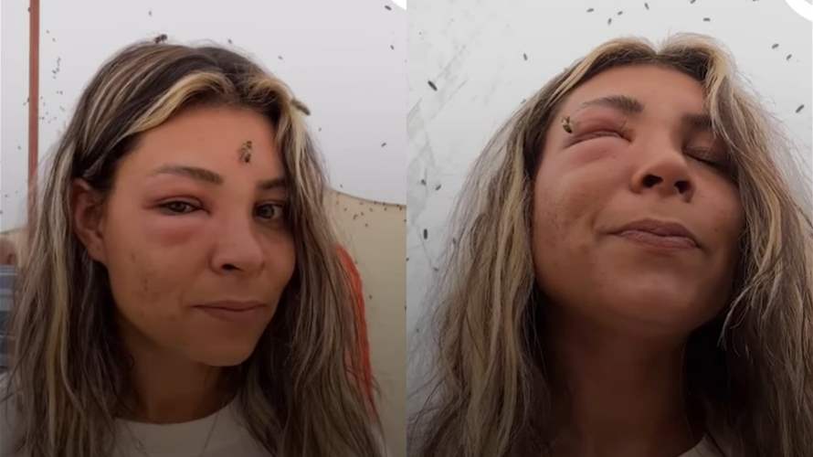 بهدوء مدهش... امرأة تُحاصرها مئات النحلات داخل خيمة دون أن تتحرك! (فيديو)
