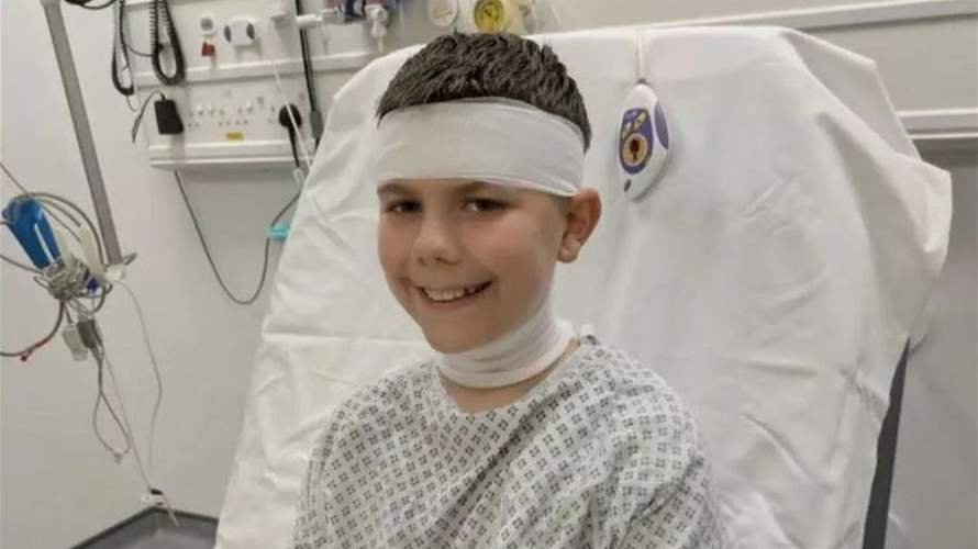 خلال عرض للألعاب النارية... إصابة خطيرة بانتظار طفل بعد محاولته حماية أخته