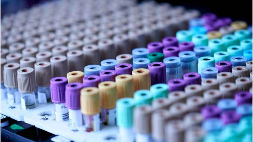 ثورة في أبحاث السكري... العلماء يكتشفون 100 بروتين قد توقف المرض قبل أن يبدأ