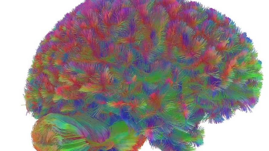 علميًا: المراهقة لا تنتهي قبل سن 32... دراسة تكشف خريطة تطوّر الدماغ 