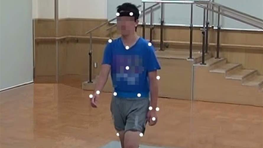 تفصيل جسدي بسيط قد يكشف التوحّد أو فرط الحركة لدى الأطفال