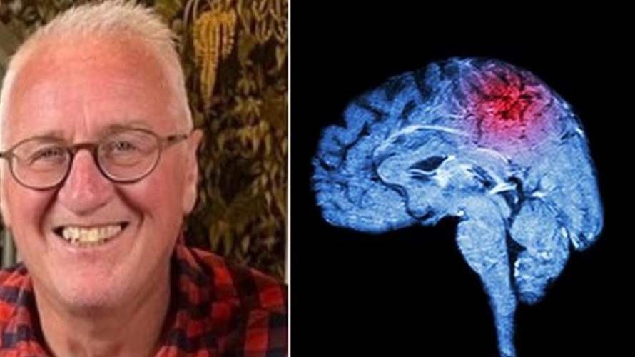 "لم أكن أعلم أنني أُصبت بجلطة دماغية"... تجربة صحية صادمة بانتظار هذا الرجل والمفاجأة كانت بالأعراض!  