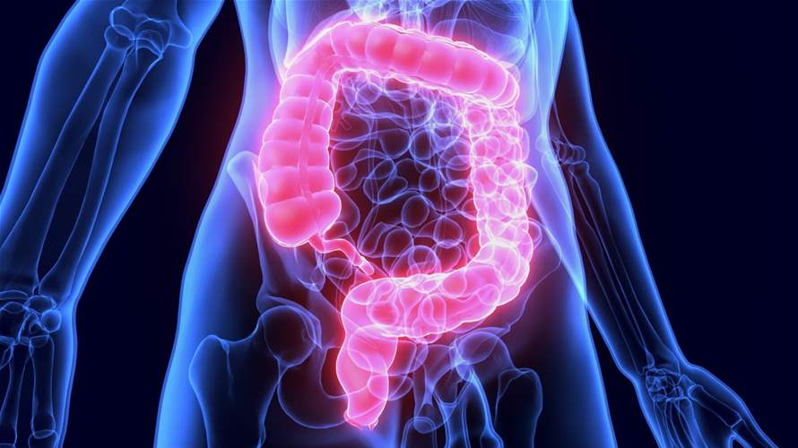 دراسة صادمة: مواليد التسعينات أكثر عرضة بأربع مرات للإصابة بسرطان القولون... وتحذيرات من منحى مقلق وغامض