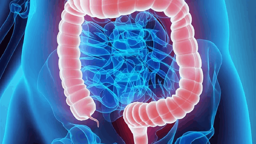 سرطان الأمعاء يهدد الشباب… خبراء يكشفون العادات اليومية التي ترفع خطر الإصابة قبل سن الخمسين
