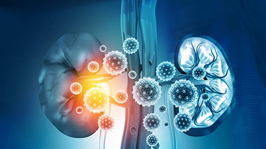 صلة بين فيروس كورونا والإصابة بأمراض الكلى... إليكم ما كشفته الأبحاث!
