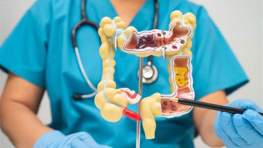 "تساعد في الوقاية من سرطان القولون"... عادة يومية تنطوي على مخاطر فورية والخبراء يحذّرون!