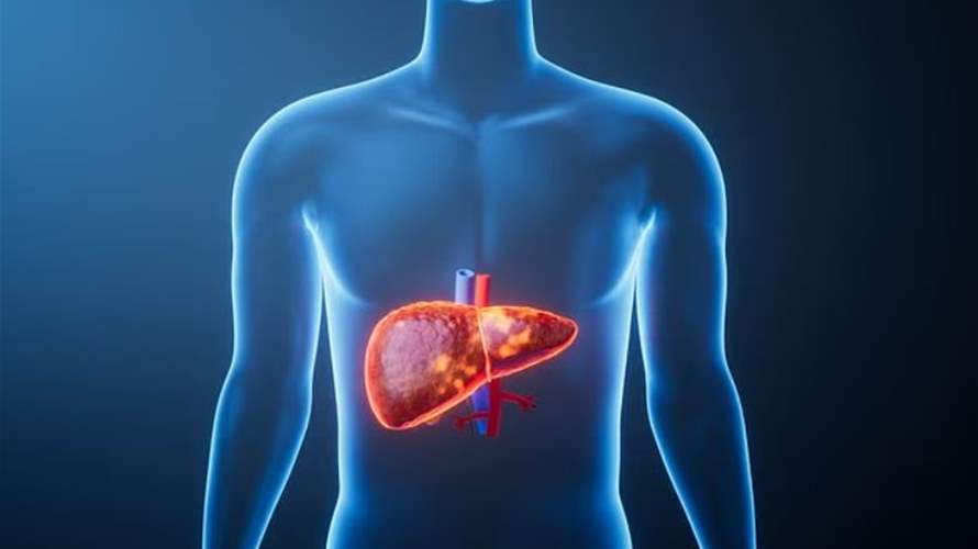 أمراض الكبد تهاجم الملايين حول العالم... وتحذيرات من وباء صامت خلال العقود القادمة!