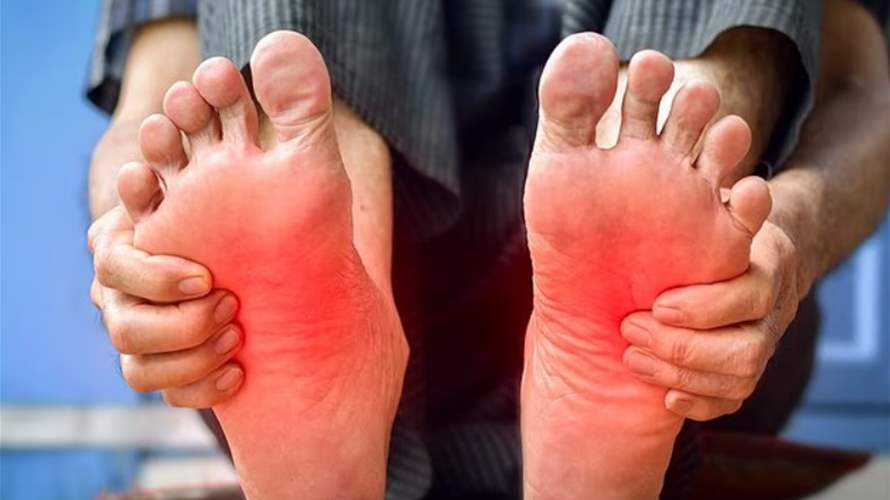 حرقان القدمين قد يكشف مرضاً خطيراً... أطباء يحذرون من تجاهل الأعراض
