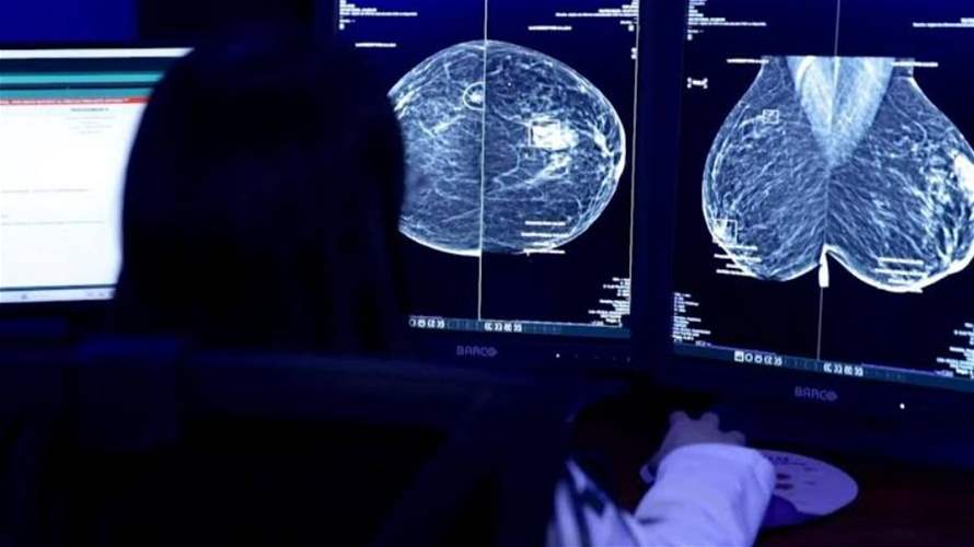 بدل انتظار أشهر... المكسيك تستعين بالذكاء الاصطناعي لاكتشاف سرطان الثدي مبكرا