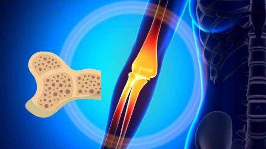 عظامك قد تكشف عمر دماغك... دراسة ترصد رابطًا مفاجئًا بين ضعف العظام وتراجع الذاكرة