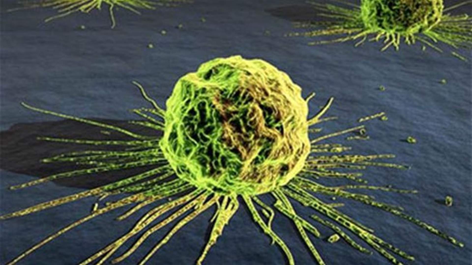 Gene study uncovers origins of many common cancers