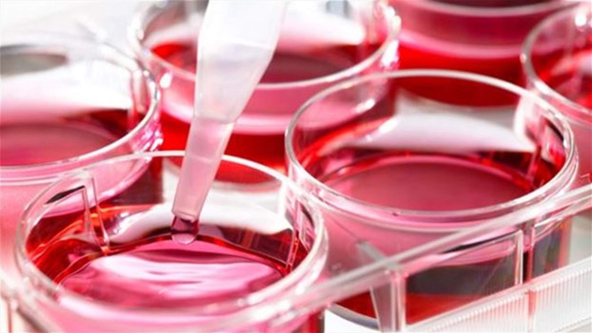 Scientists grow "mini human brains" from stem cells