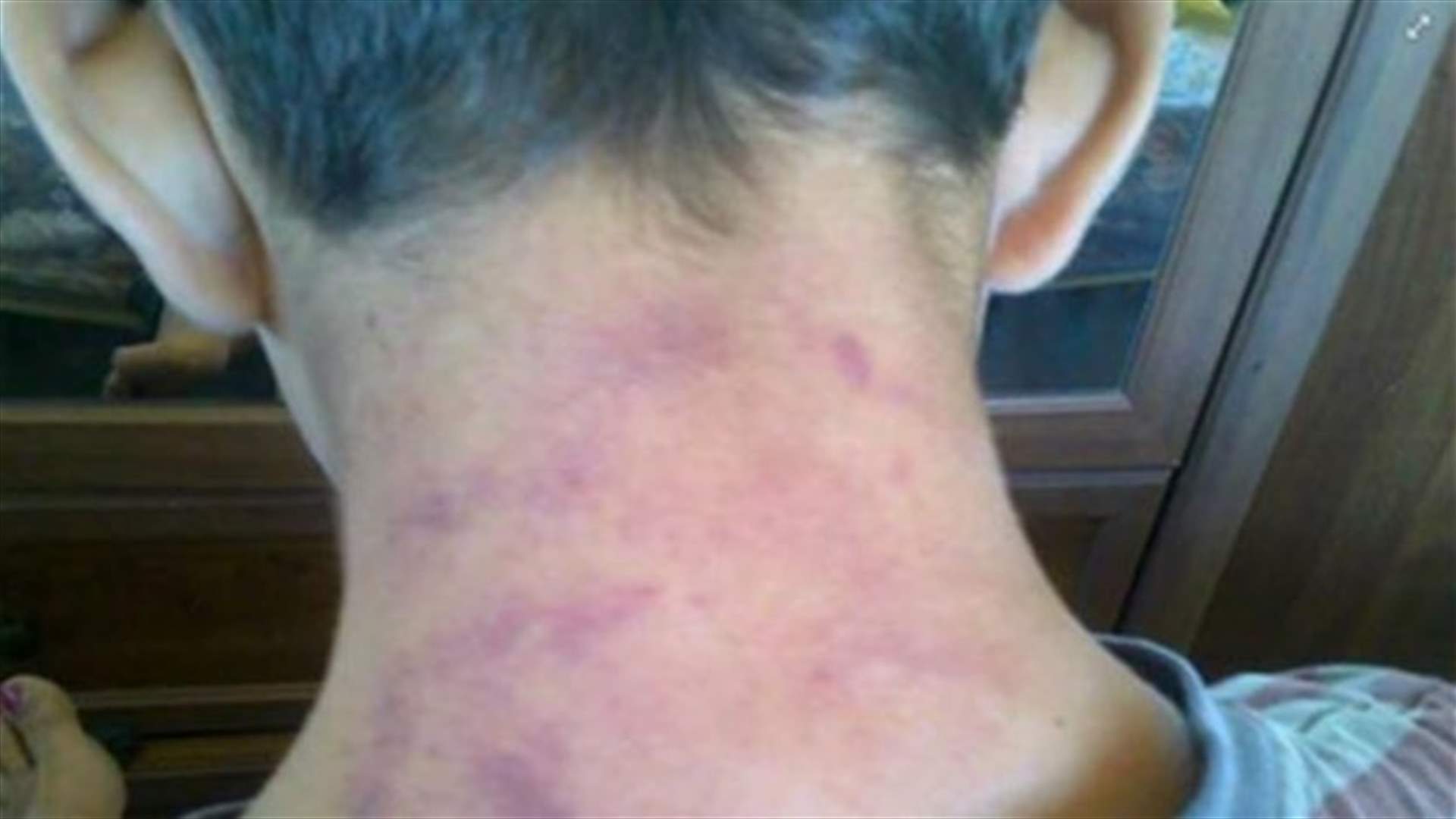 REPORT: Teacher asks students to severely beat classmate
