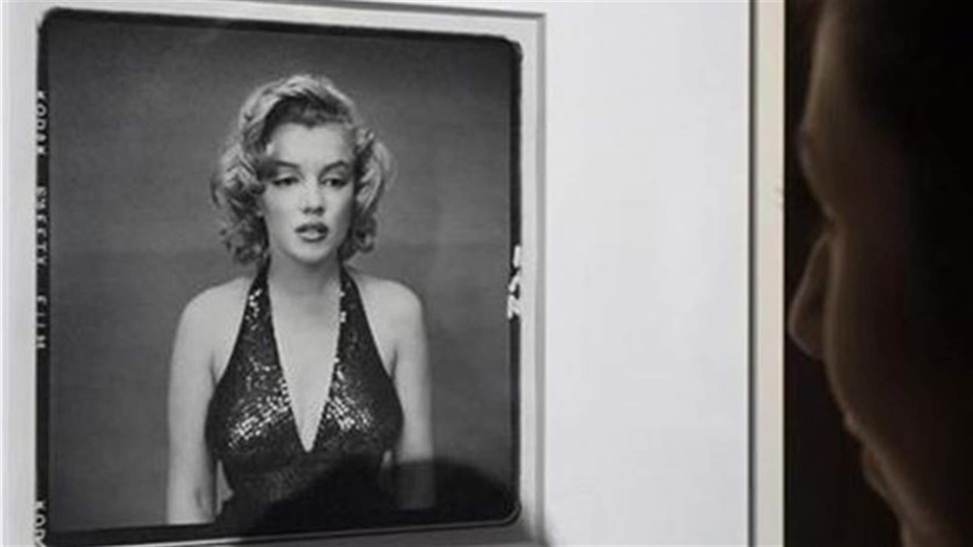 Marilyn Monroe plastic surgery notes, X-rays up for auction