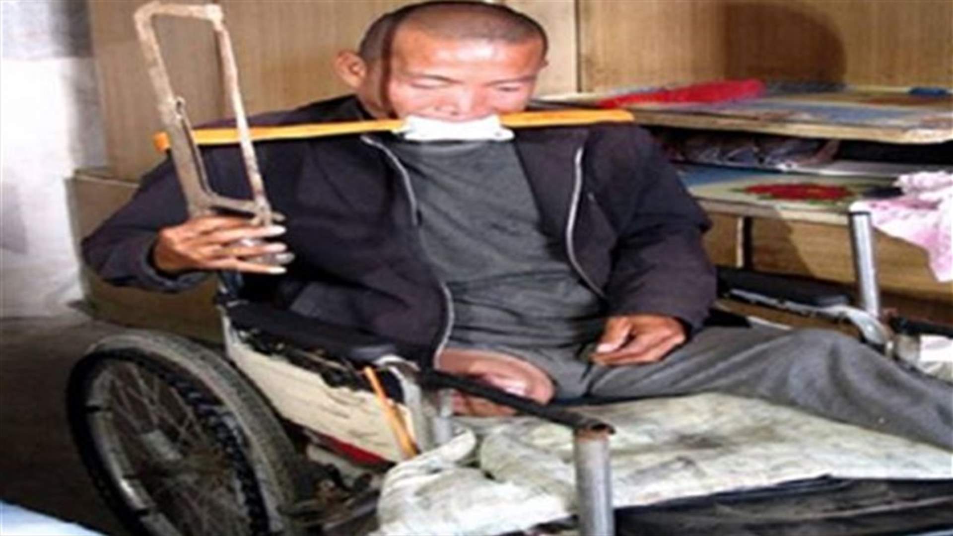 Man saws off own leg to avoid hospital bills 