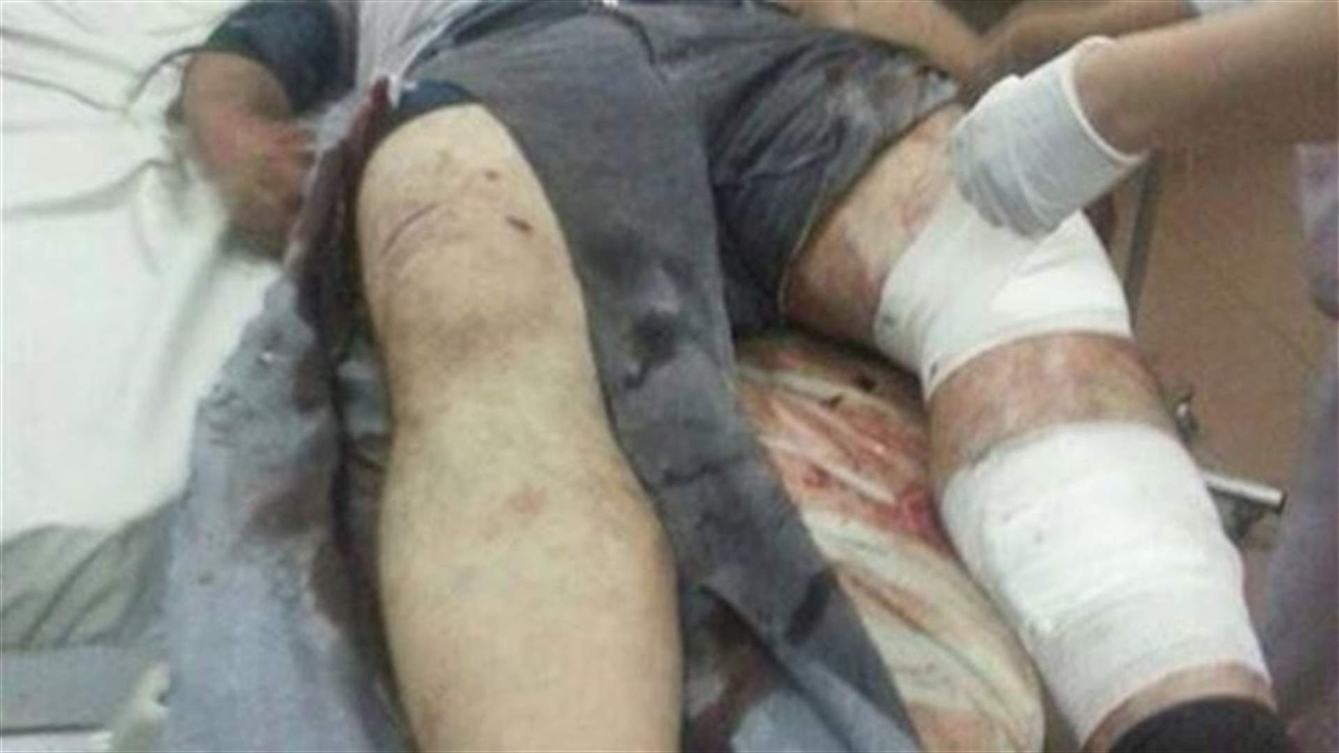 Separate incidents injure several people in Tripoli