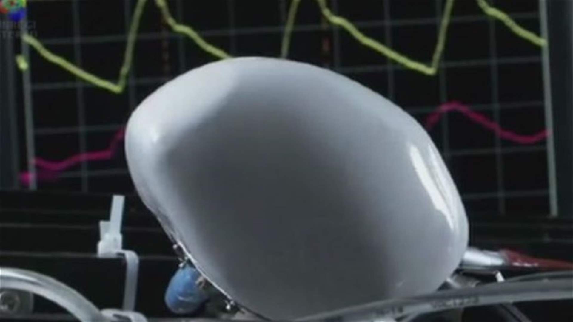 REPORT: French company performs first artificial heart transplant