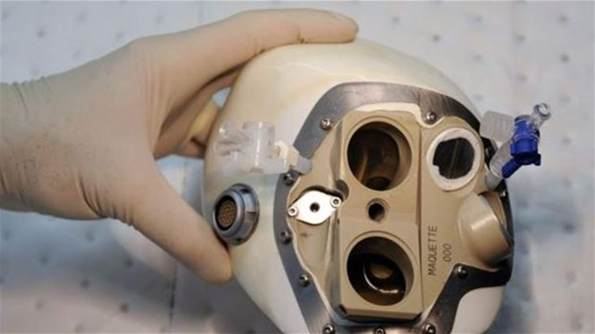 Carmat artificial heart patient in good condition -hospital