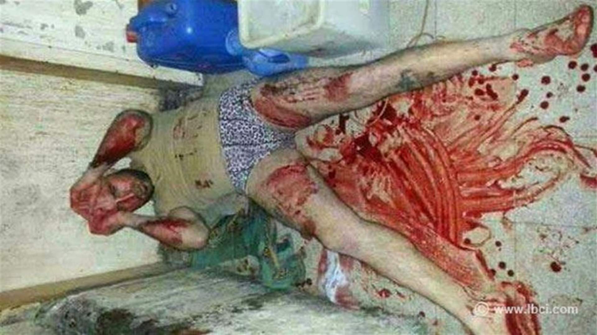 الاعتداء بالضرب على شاب من جبل محسن في البقار 