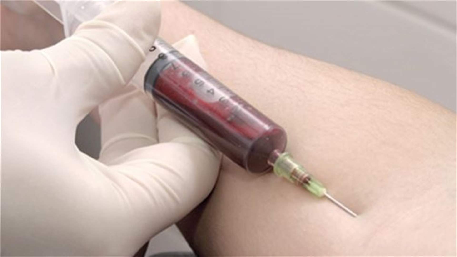 "Blood Death test" reveals if you'll be alive in five years 
