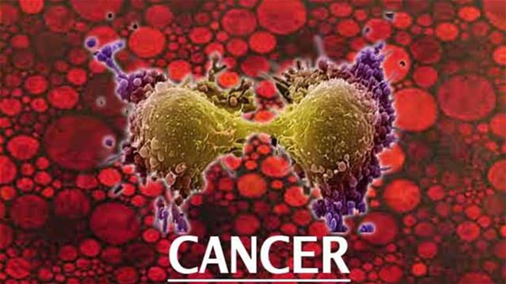 كيف تتغذى الخلايا السرطانية وكيف نقضي عليها؟