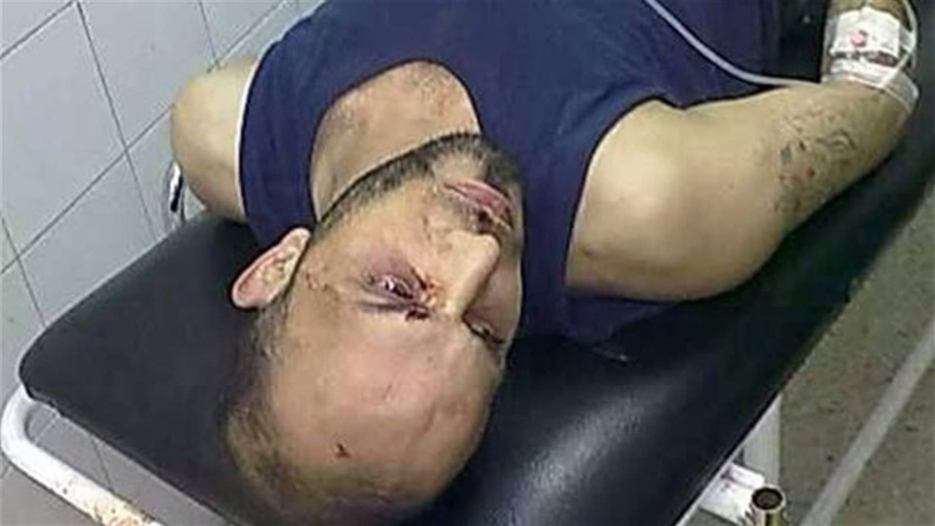 REPORT: Girl killed, 10 injured in Tripoli clashes