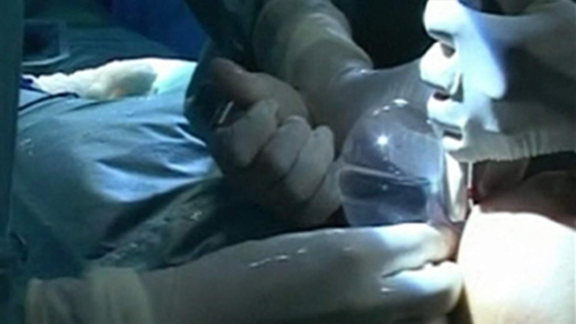  Are carcinogenic breast implants a threat to Lebanese women?  