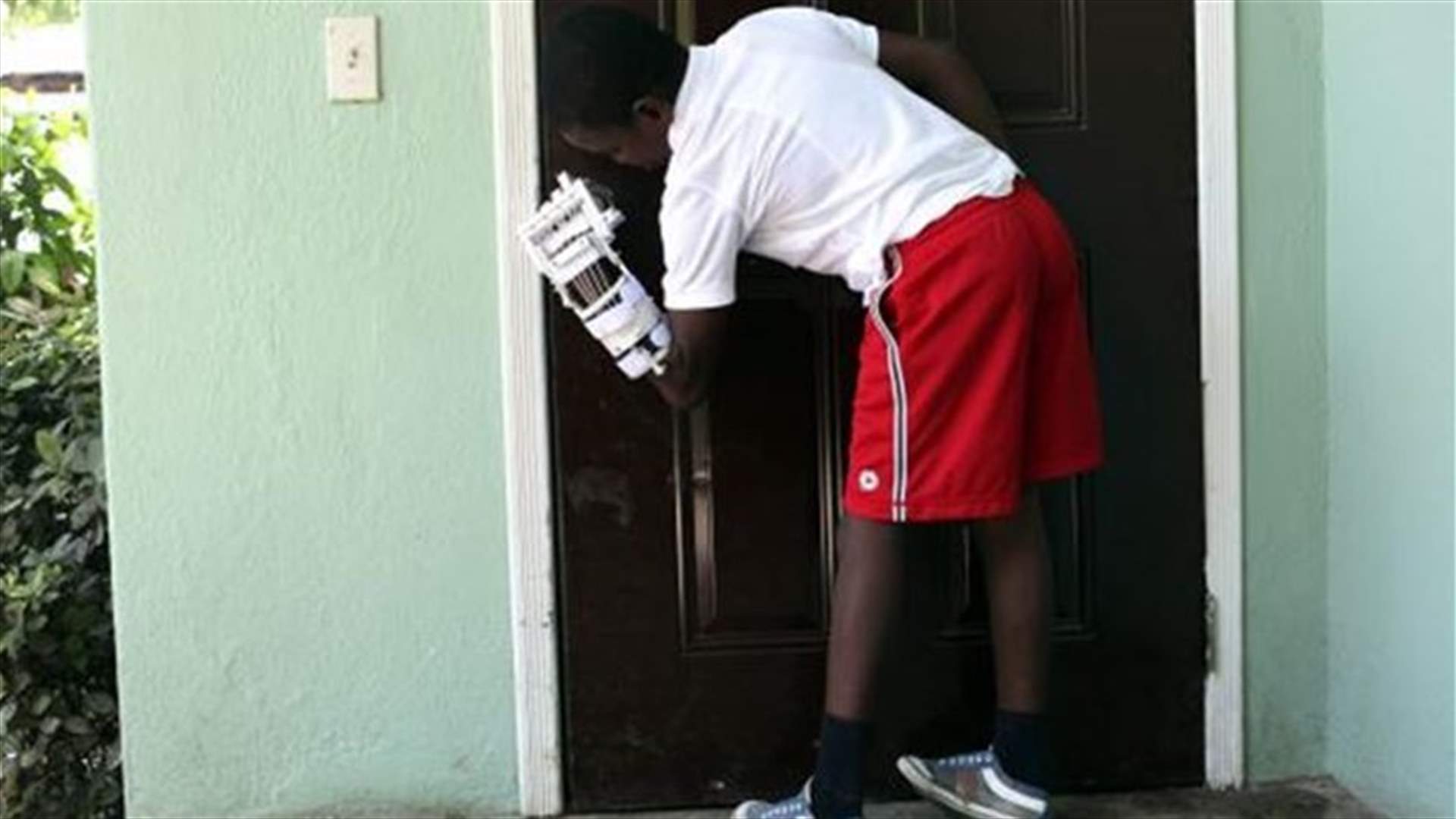 Haitian orphan gets nation's first 3-D printer prosthesis
