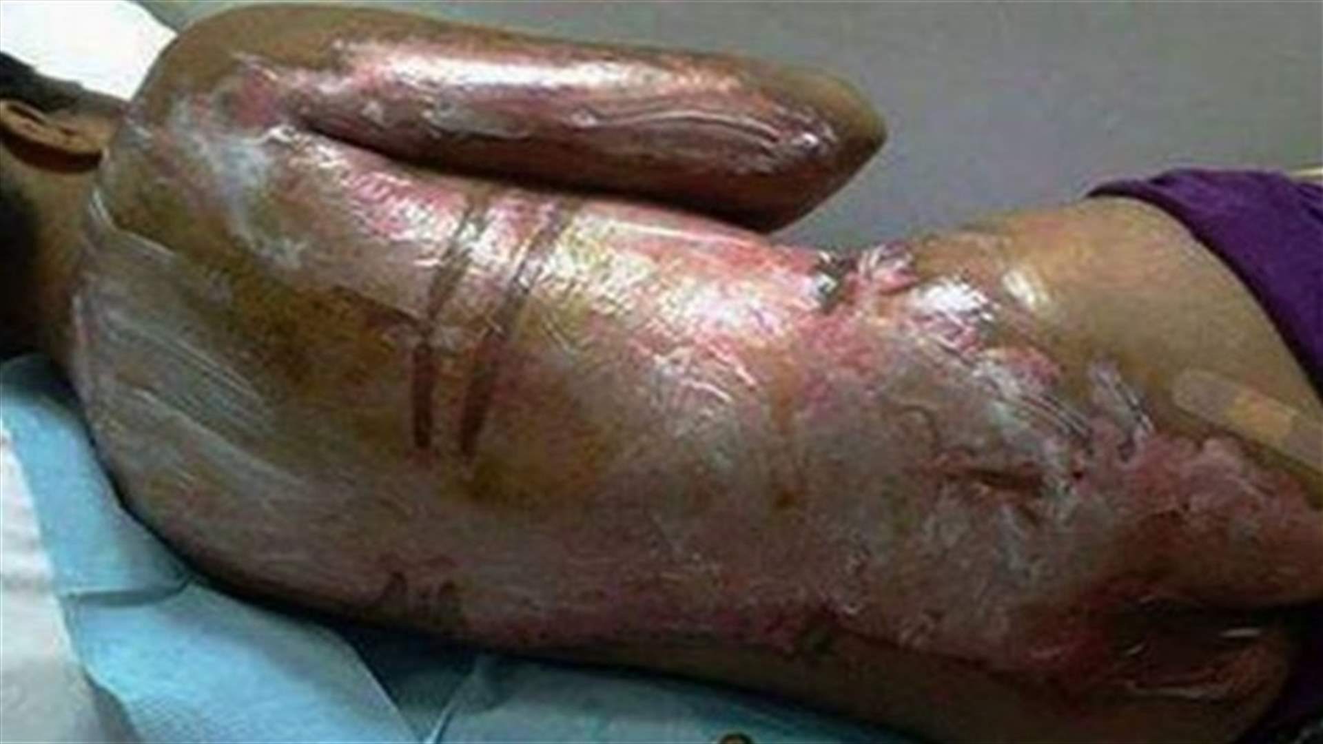Saudi woman pours boiling water over maid for not making coffee quick enough