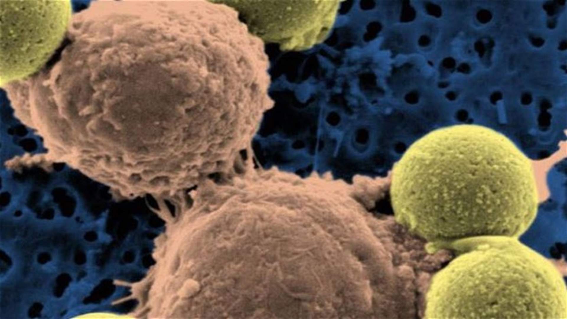 Pharmacyclics, J&J drug shown to improve leukemia survival