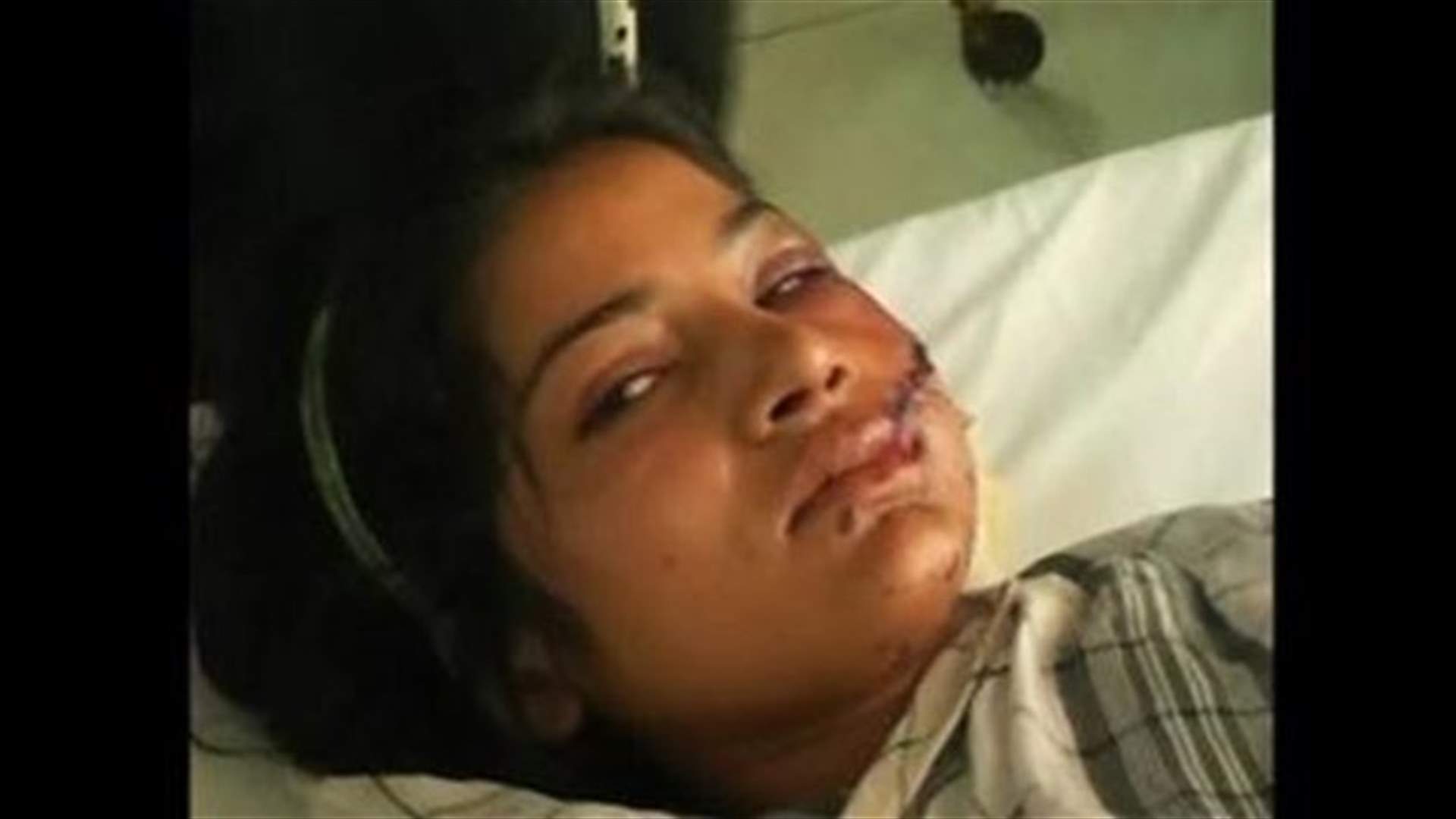 Pakistan survivor of honor killing attempt fears for her life