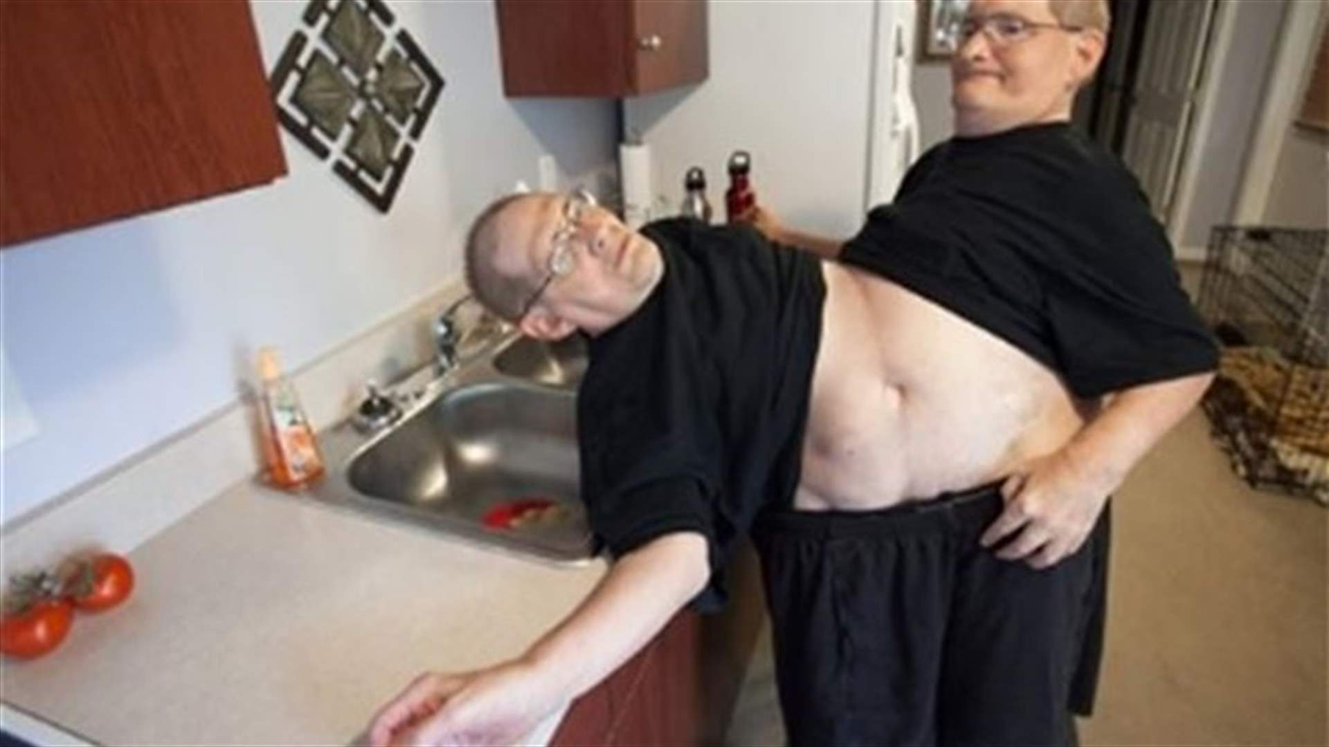 Conjoined Ohio twins, 62, mark a milestone