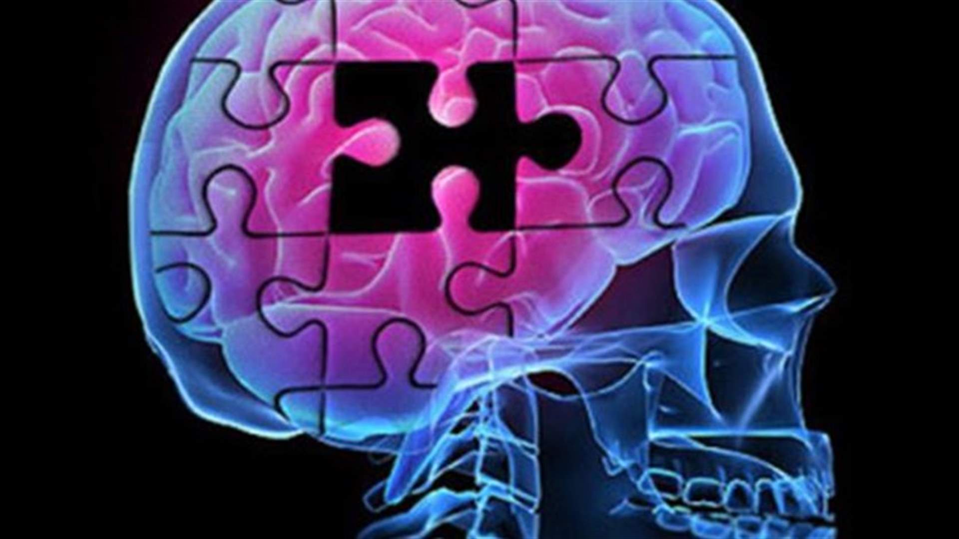 German database study hints diabetes drug cuts Alzheimer's risk