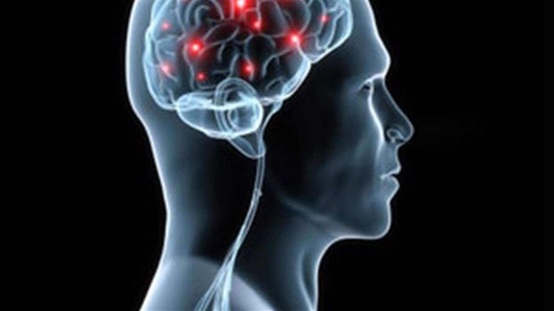 Schizophrenia has many genetic links, study says