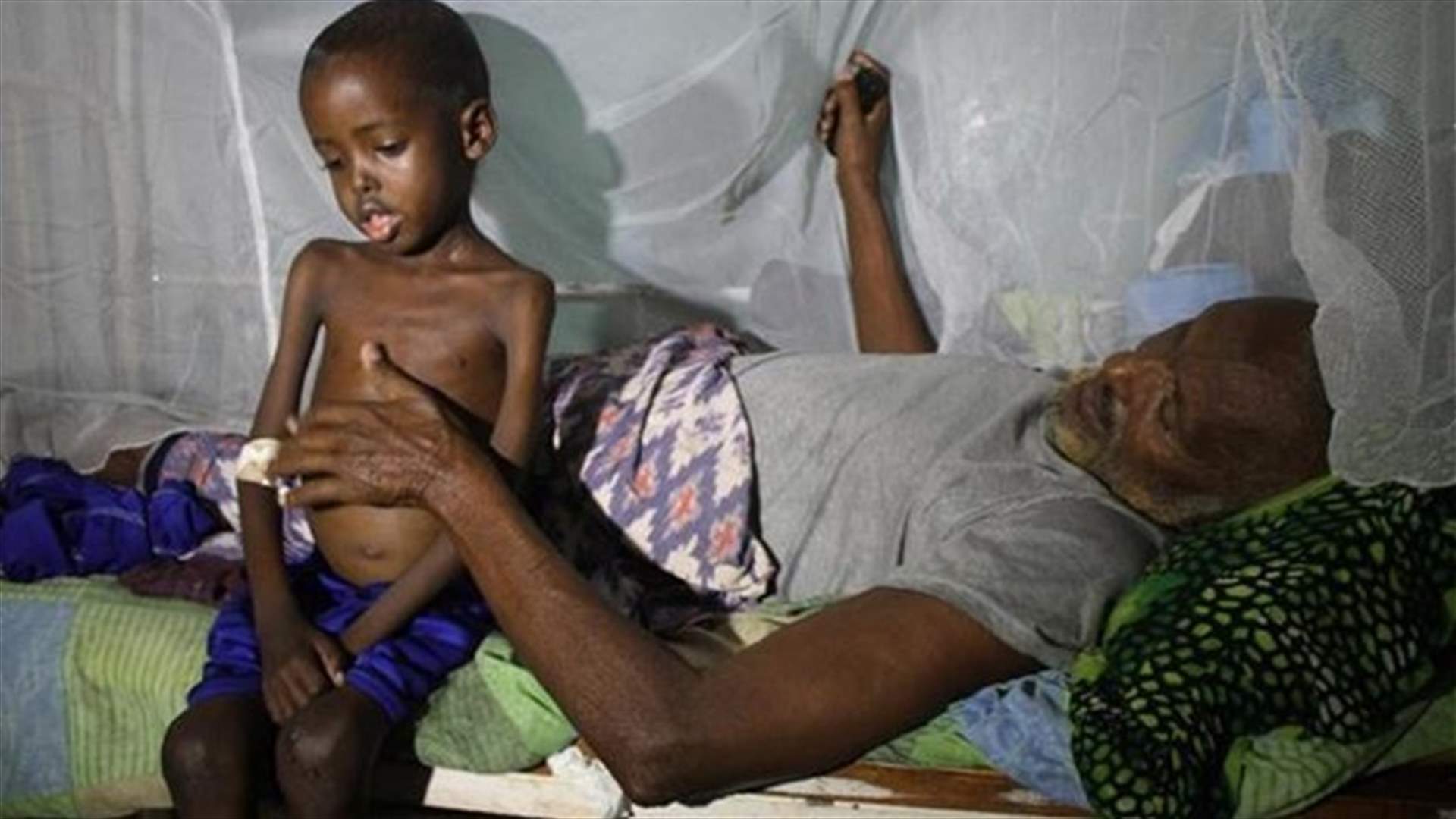 UN warns of alarming malnutrition rates in Somali capital