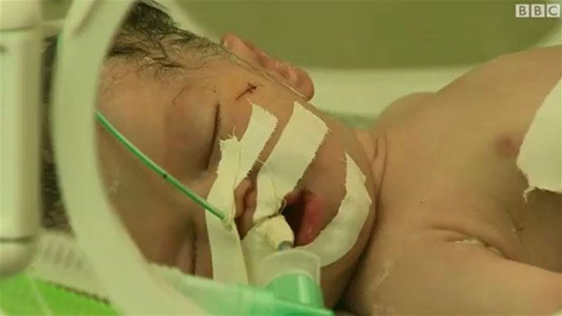 استشهدت في غارة إسرائيلية ولكن الجنين خرج حيّاً من رحمها