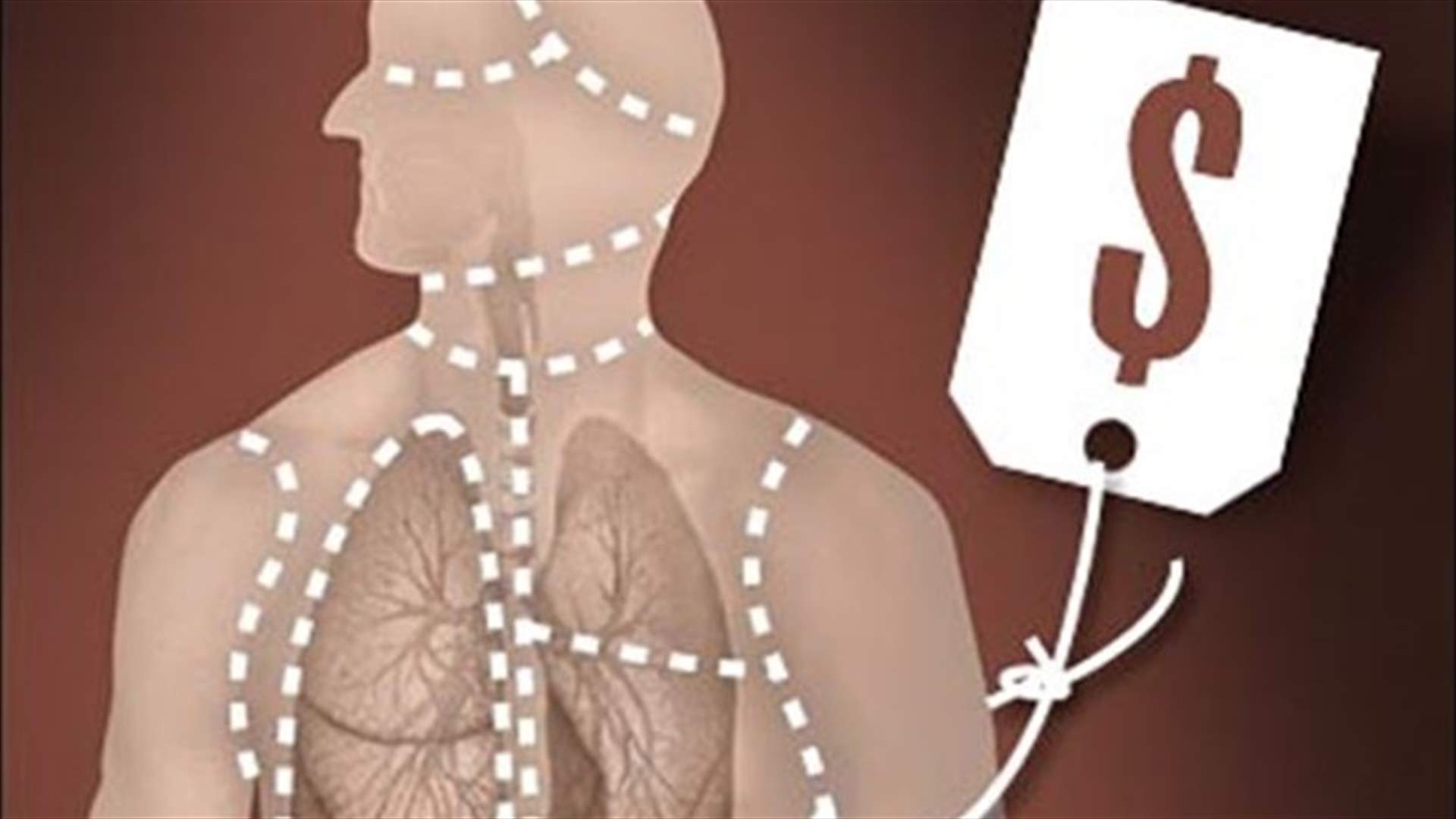 Inquiry finds "indications" of organ harvesting in Kosovo conflict