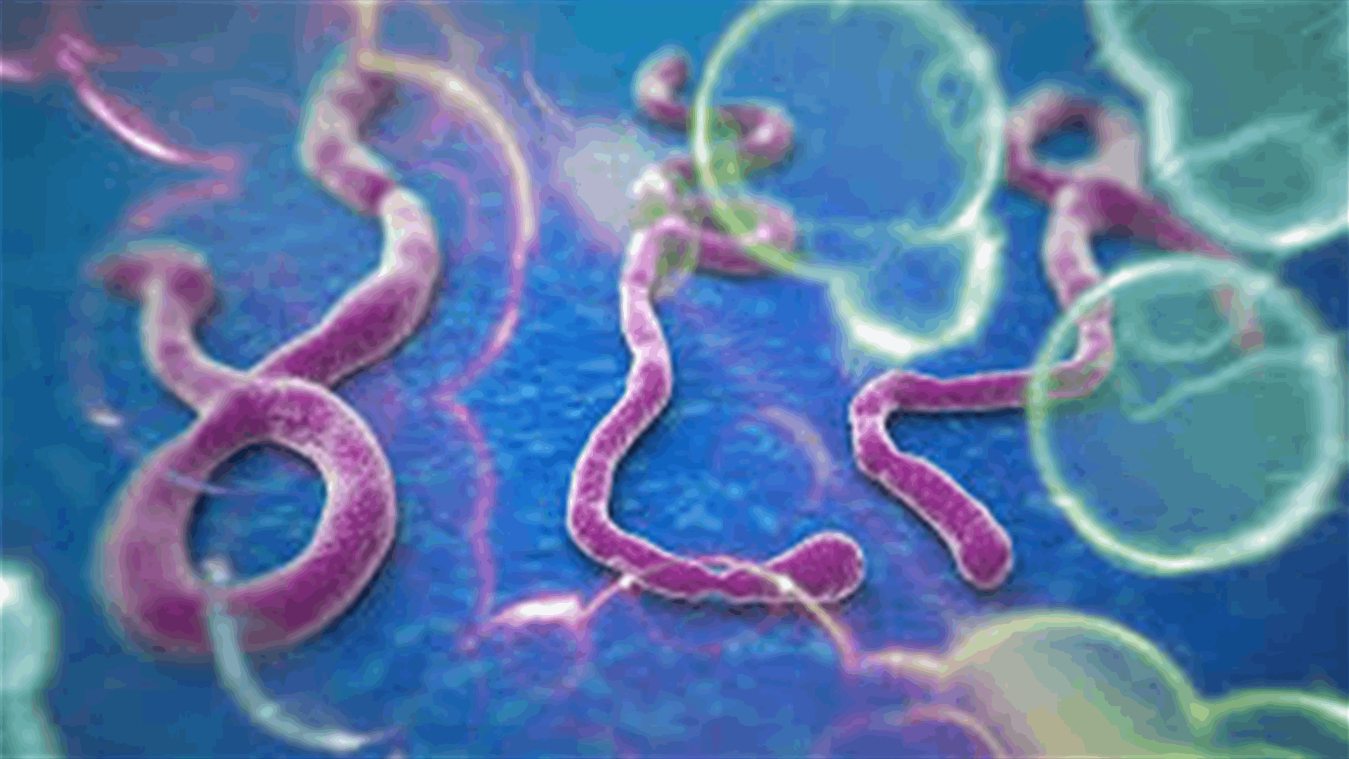 IMF says Ebola hits economic growth in W. Africa