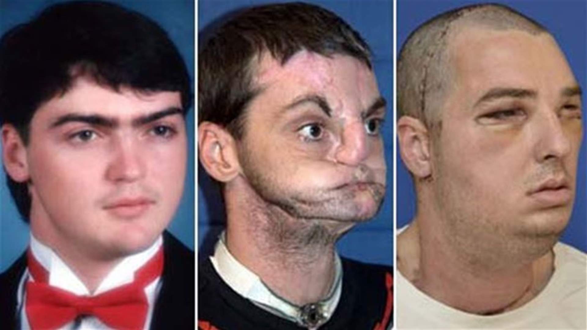 The Man Without A Face Finds Love