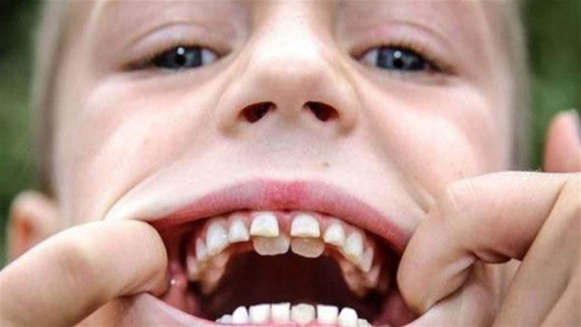 "الفك المفترس" ... زاك براون