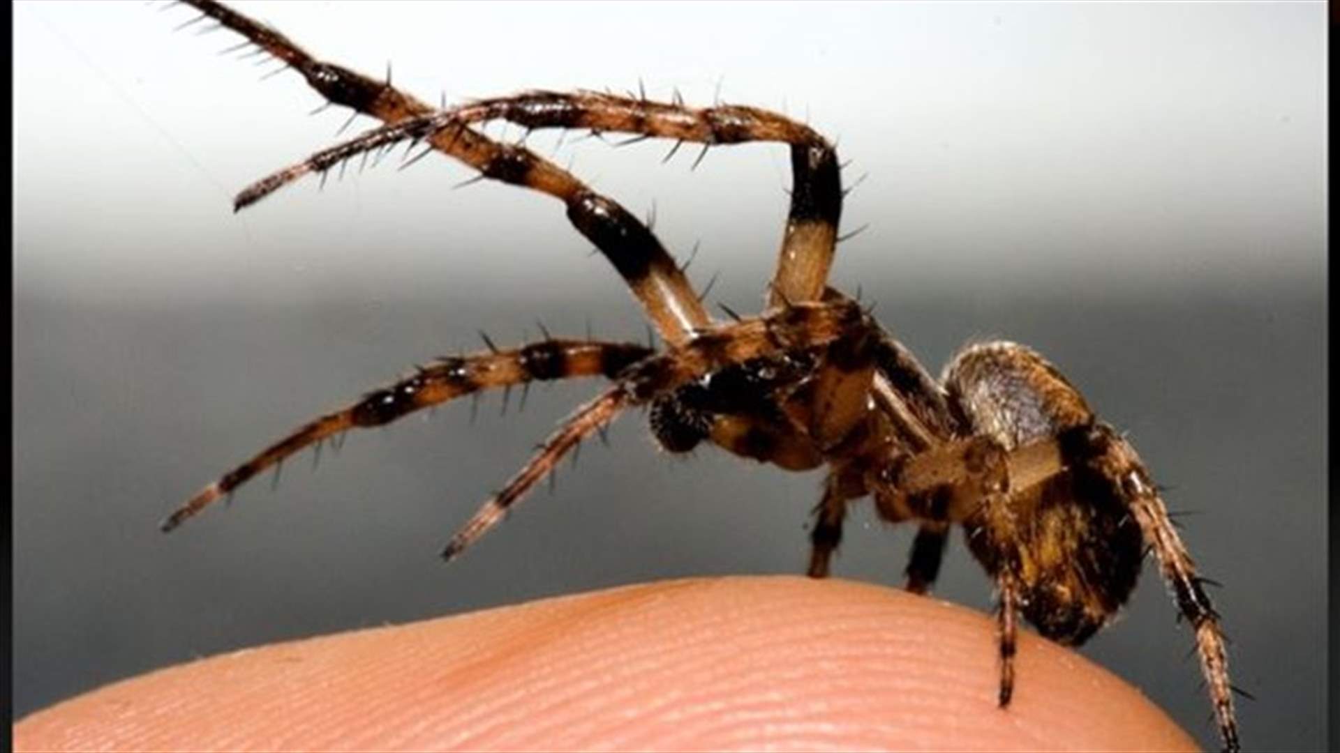 Australian Returns Home From Holiday With Spider In Stomach