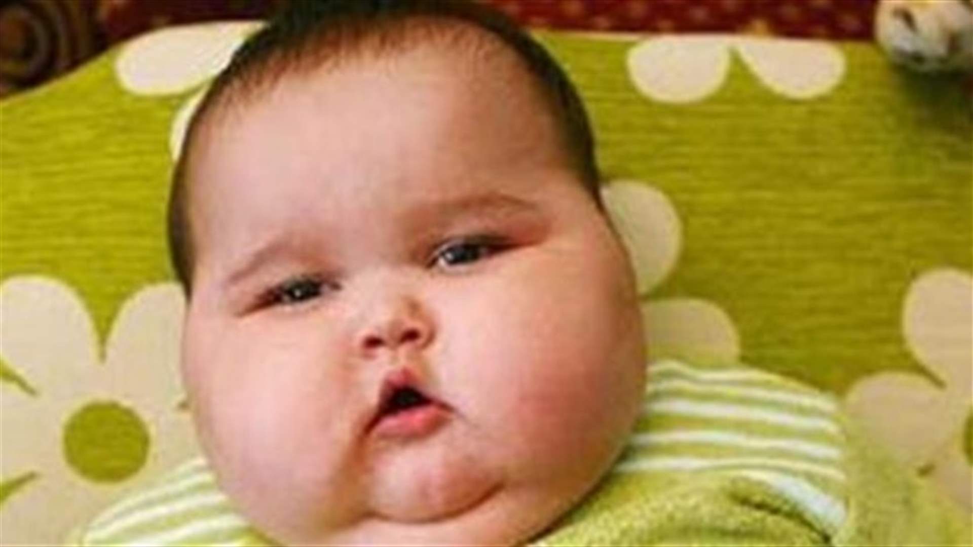 السمنة تغير شكل القلب لدى الاطفال
